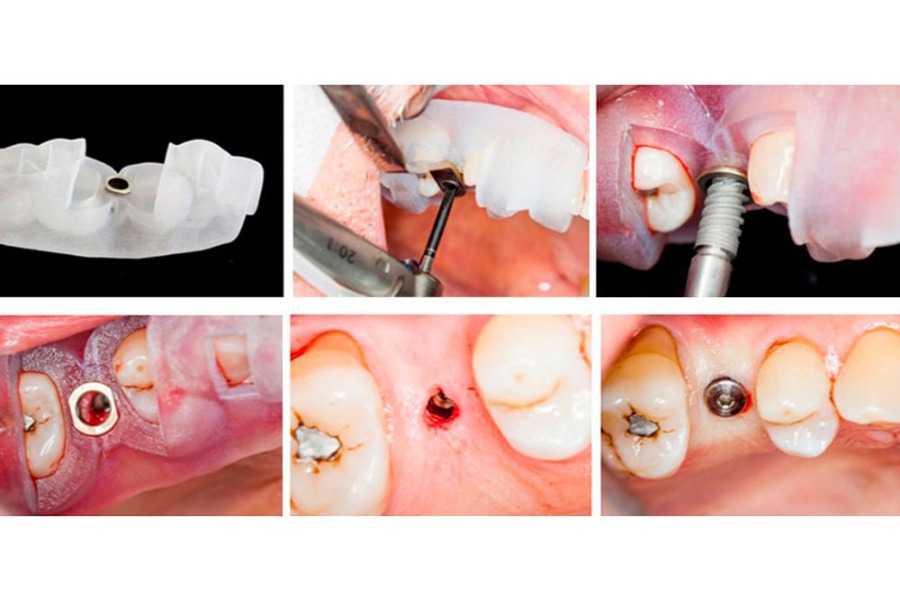 Cirurgia Guiada