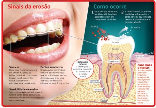 Eroso Dental