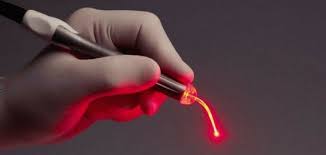laser