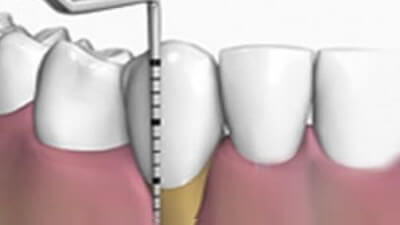 periodontia